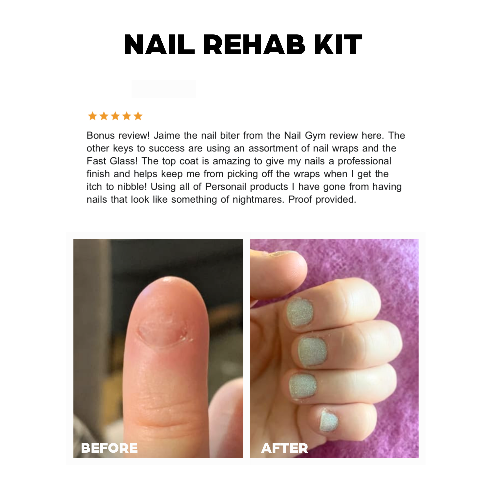 The Nail Biter Recovery Kit
